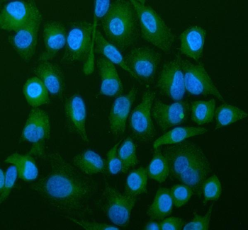 ATP5G1,2,3/ATP5MC1,2,3 Antibody