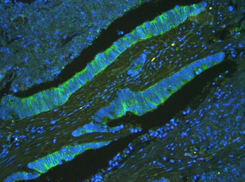 ATP5G1,2,3/ATP5MC1,2,3 Antibody