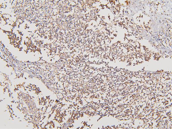 ATP5G1,2,3/ATP5MC1,2,3 Antibody