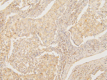 ATP5G1,2,3/ATP5MC1,2,3 Antibody