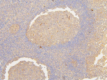 ATP5G1,2,3/ATP5MC1,2,3 Antibody