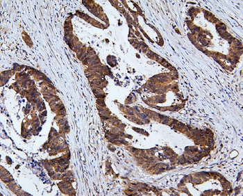 RNF169 Rabbit Polyclonal Antibody