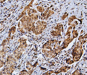 RNF169 Rabbit Polyclonal Antibody