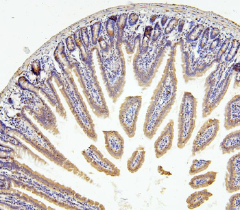 RNF169 Rabbit Polyclonal Antibody