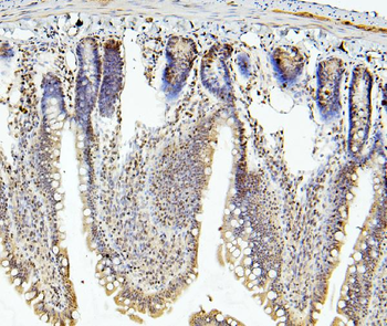 RNF169 Rabbit Polyclonal Antibody