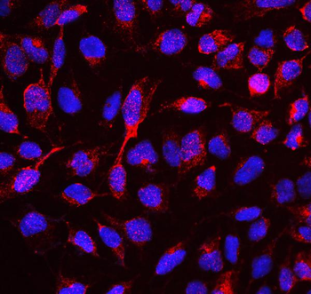 RBMS3 Rabbit Polyclonal Antibody