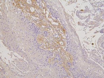 RBMS3 Rabbit Polyclonal Antibody