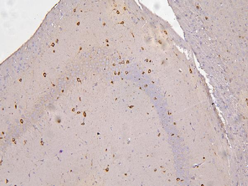 RBMS3 Rabbit Polyclonal Antibody