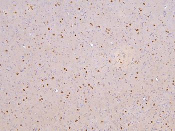 RBMS3 Rabbit Polyclonal Antibody