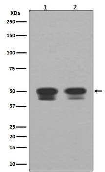 p53 TP53 Rabbit Monoclonal Antibody