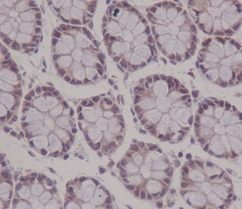 APC Rabbit Monoclonal Antibody (APC)