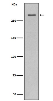 ATM Rabbit Monoclonal Antibody