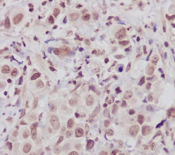 ATM Rabbit Monoclonal Antibody