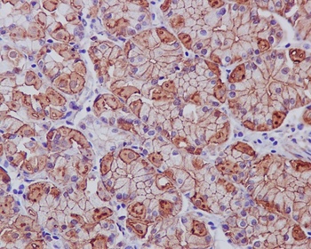 EGFR Rabbit Monoclonal Antibody