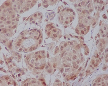 AKT1 Rabbit Monoclonal Antibody
