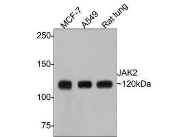 JAK2 Rabbit Monoclonal Antibody