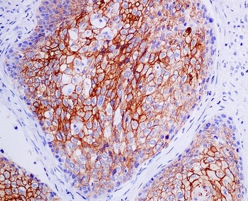 CXCR4 Monoclonal Antibody