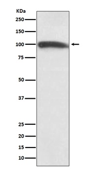 KMT6/EZH2 Rabbit Monoclonal Antibody