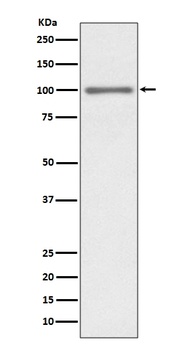KMT6/EZH2 Rabbit Monoclonal Antibody