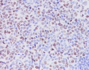 KMT6/EZH2 Rabbit Monoclonal Antibody