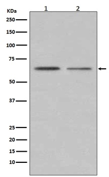 ER alpha ESR1 Rabbit Monoclonal Antibody