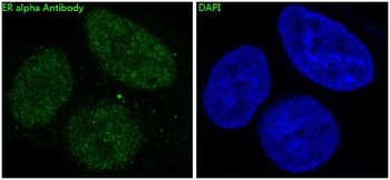 ER alpha ESR1 Rabbit Monoclonal Antibody