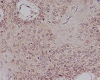 ER alpha ESR1 Rabbit Monoclonal Antibody