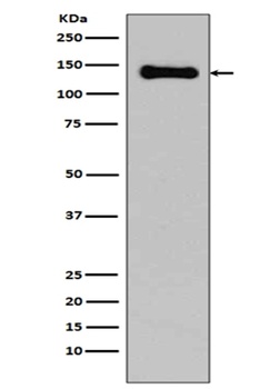 pan Cadherin 1 CDH1 Rabbit Monoclonal Antibody
