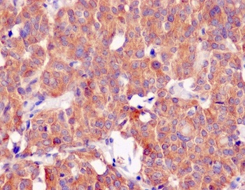 CLOCK Rabbit Monoclonal Antibody