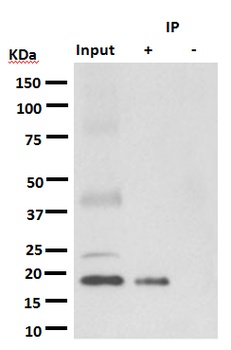 KRAS+HRAS+NRAS/KRAS Rabbit Monoclonal Antibody