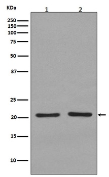 KRAS+HRAS+NRAS/KRAS Rabbit Monoclonal Antibody