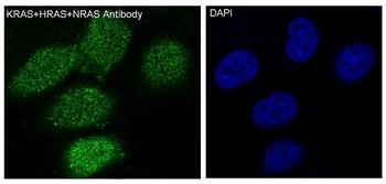 KRAS+HRAS+NRAS/KRAS Rabbit Monoclonal Antibody