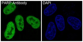 PARP PARP1 Rabbit Monoclonal Antibody