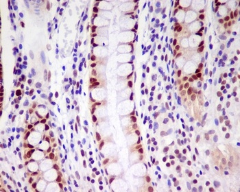 PCNA Rabbit Monoclonal Antibody