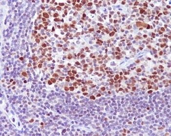 Bcl-6 Rabbit Monoclonal Antibody