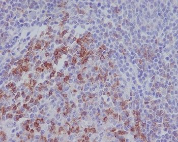 PD1 PDCD1 Rabbit Monoclonal Antibody