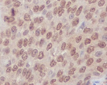 Rho A + B + C Rabbit Monoclonal Antibody