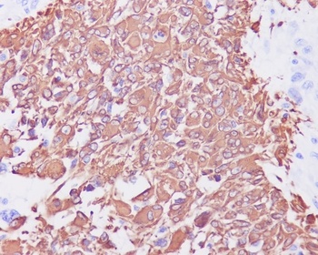 GFAP Rabbit Monoclonal Antibody