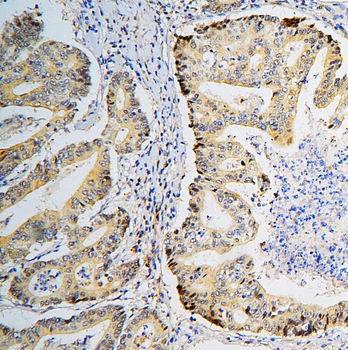 BRG1 SMARCA4 Antibody (monoclonal, 3F4)