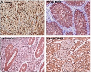 GAPDH Rabbit Monoclonal Antibody