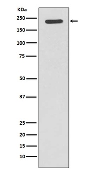 Tuberin TSC2 Rabbit Monoclonal Antibody