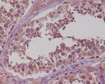 NAK/TBK1 Rabbit Monoclonal Antibody