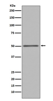 FOXA1/Hnf 3 Alpha Rabbit Monoclonal Antibody
