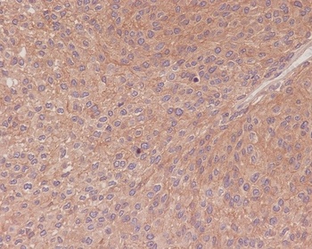 NF-Kappa B p65 RELA/NF Rabbit Monoclonal Antibody