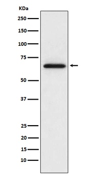 MMP2 Rabbit Monoclonal Antibody