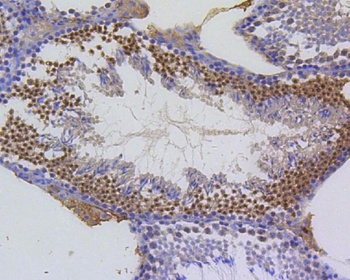 Survivin Birc5 Rabbit Monoclonal Antibody