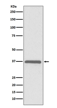 ERCC1 Rabbit Monoclonal Antibody