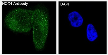 NOX4 Rabbit Monoclonal Antibody