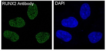 RUNX2 Monoclonal Antibody