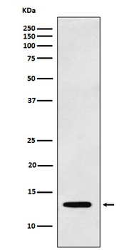 Galectin 1/LGALS1 Rabbit Monoclonal Antibody
